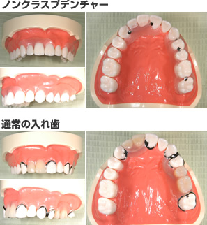 エックス線検査